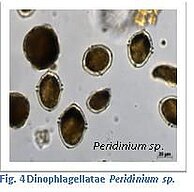 Figure 4. Dinophlagellatae Peridinium sp